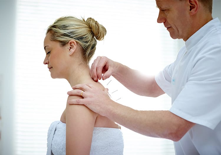 acupuncture for pain