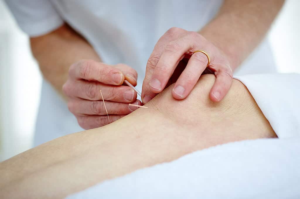 Best Acupuncture Clinic in Brampton