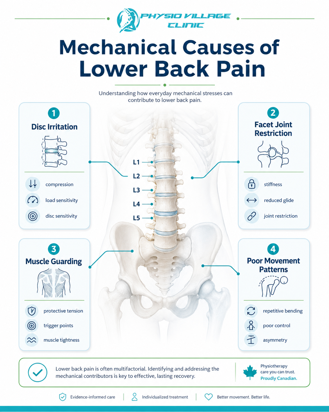 Clinical infographic showing four mechanical causes of lower back pain disc irritation, facet joint restriction, muscle guarding, and poor movement patterns.