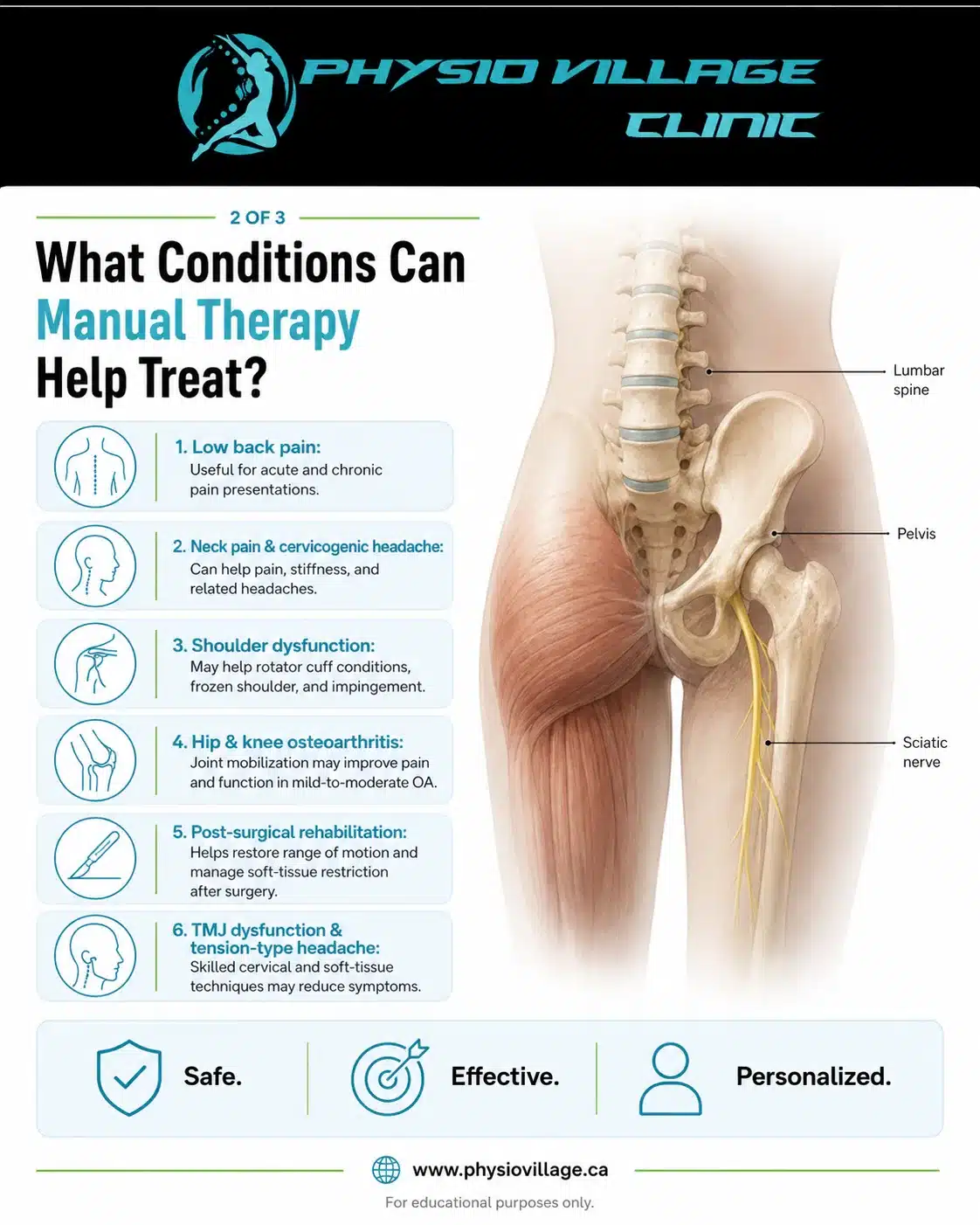 Clinical infographic showing physiotherapy-based sciatica treatment options including manual therapy, nerve mobilization, exercise, stretching, posture education, and acupuncture support.