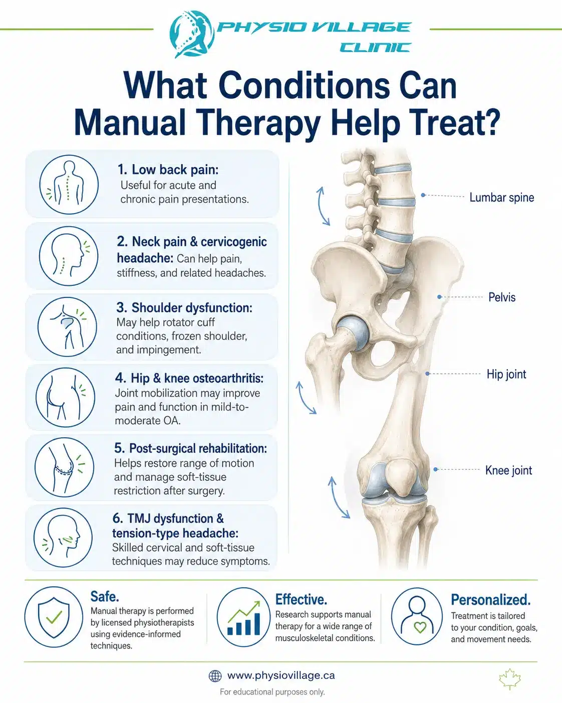 Clinical pathway infographic showing osteoarthritis physiotherapy care through assessment, manual therapy, strengthening, mobility, load management, and joint protection.