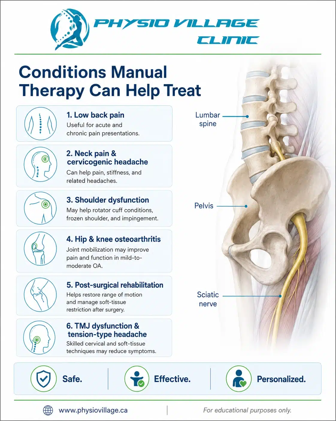 Physiotherapy treatment pathway for sciatica showing assessment, manual therapy, nerve mobilization, therapeutic exercise, and posture education.